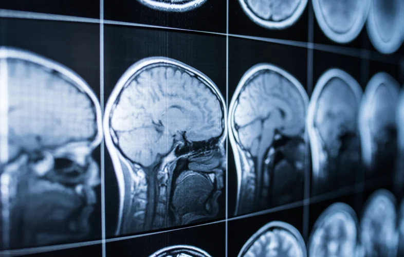 Brain scans